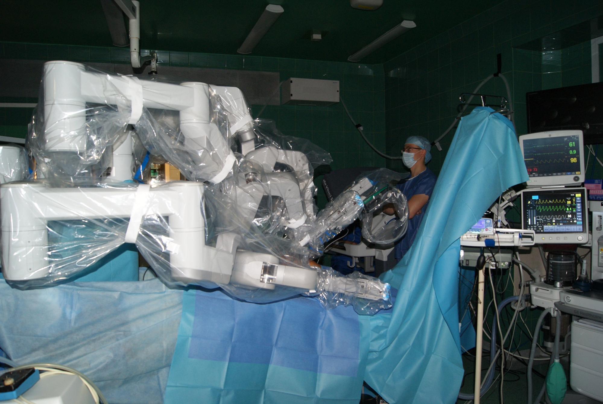 Operacje z użyciem robota daVinci w Szpitalu Uniwersyteckim nr 2 im. dr. Jana Biziela w Bydgoszczy